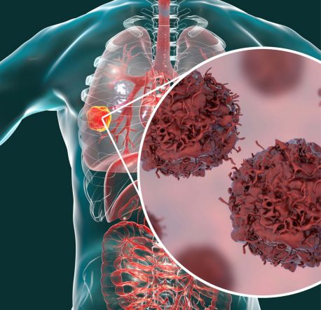 Krebs_Heilerin Mölln